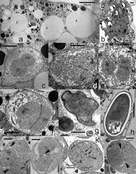 Attēlu rezultāti vaicājumam “Capsus ater imago”