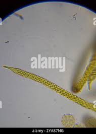 Attēlu rezultāti vaicājumam “Oligonema persimile macro”