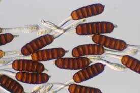 Attēlu rezultāti vaicājumam “Phragmidium sp.”