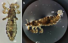 Attēlu rezultāti vaicājumam “Pediculus humanus capitis”