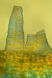 Attēlu rezultāti vaicājumam “Orthotrichum speciosum sporophyte”