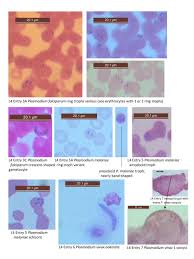 Attēlu rezultāti vaicājumam “Reticularia lobata plasmodium”