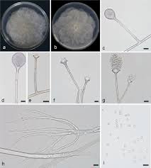Attēlu rezultāti vaicājumam “Amaurochaete fusiformis spores”