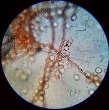 Attēlu rezultāti vaicājumam “Arcyria affinis macro”