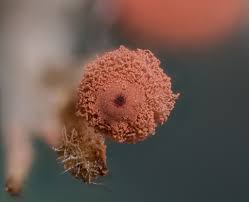 Attēlu rezultāti vaicājumam “Arcyria denudata spores”