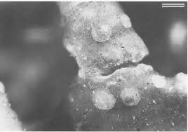 Attēlu rezultāti vaicājumam “Biatoropsis usnearum”