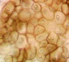 Attēlu rezultāti vaicājumam “Lycogala cf. fossiculatum sessile”