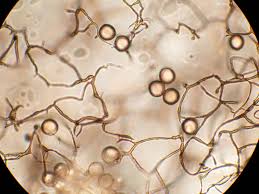 Attēlu rezultāti vaicājumam “Stemonitopsis aequalis (var. aequalis) macro”