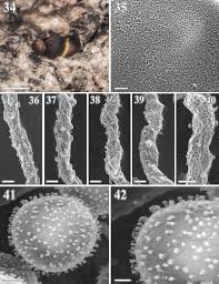 Attēlu rezultāti vaicājumam “Perichaena depressa spores”