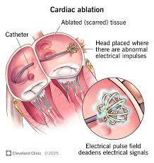 Image result for inthe.es