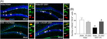 Image result for b%FD%E7ak anatomisi