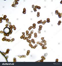 Attēlu rezultāti vaicājumam “Tranzschelia pruni-spinosae”