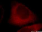 CYP1A2-Specific Antibody 19936-1-AP PView | Proteintech