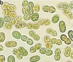 Attēlu rezultāti vaicājumam “Gloeocapsa rupestris”