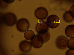 Attēlu rezultāti vaicājumam “Amaurochaete atra macro”