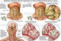 Stellate Ganglion Block (cervicothoracic sympathetic block ...