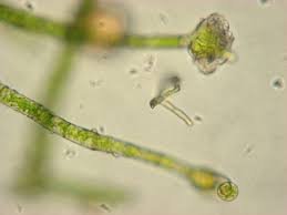 Attēlu rezultāti vaicājumam “Trentepohlia sp.”
