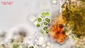 Attēlu rezultāti vaicājumam “Gloeocapsa rupestris”