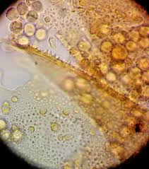 Attēlu rezultāti vaicājumam “Heterotrichia oerstedii (syn. Arcyria oerstedii) macro”