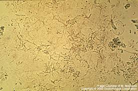 Attēlu rezultāti vaicājumam “Badhamia versicolor spores”