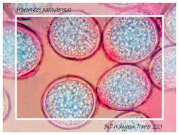 Attēlu rezultāti vaicājumam “Milesina murariae”