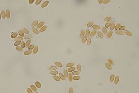 Attēlu rezultāti vaicājumam “Dumontinia tuberosa”