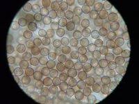 Attēlu rezultāti vaicājumam “Badhamia sp.”