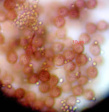 Attēlu rezultāti vaicājumam “Diderma chondrioderma macro”