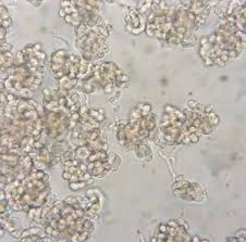 Attēlu rezultāti vaicājumam “Illosporiopsis christiansenii”