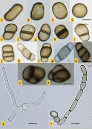 Attēlu rezultāti vaicājumam “Dianema nivale spores”