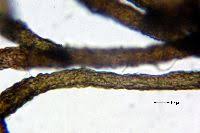 Attēlu rezultāti vaicājumam “Cystocoleus ebeneus”