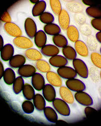 Attēlu rezultāti vaicājumam “Octospora splachnophila spores”