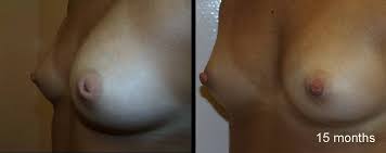 http://t0.gstatic.com/images?q=tbn:ANd9GcQWgAqSeAC1CqOp-Djdb72zu9mmEZQbEhidFUwx8lmhdk10JMOjlg