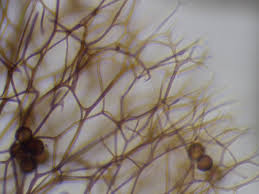 Attēlu rezultāti vaicājumam “Lamproderma echinosporum”