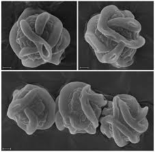 Attēlu rezultāti vaicājumam “Lamprospora tortulae-ruralis”