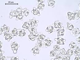 Attēlu rezultāti vaicājumam “Diplophyllum albicans”