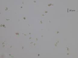 Attēlu rezultāti vaicājumam “Microcalicium disseminatum”