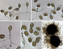 Attēlu rezultāti vaicājumam “Stemonitopsis aequalis var. microspora spores”