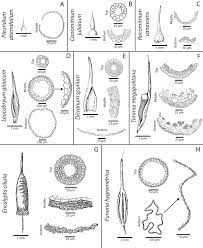 Attēlu rezultāti vaicājumam “Racomitrium canescens sporophyte”