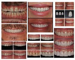 Image result for Smiles For Everyone