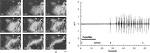 Optical intrinsic signal imaging in a rodent seizure model