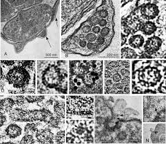 Attēlu rezultāti vaicājumam “Colloderma oculatum plasmodium”