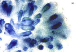 Attēlu rezultāti vaicājumam “Lecanora albella”