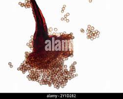 Attēlu rezultāti vaicājumam “Stemonitis splendens spores”