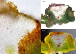 Attēlu rezultāti vaicājumam “Candelariella sp.”