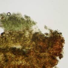 Attēlu rezultāti vaicājumam “Microcalicium disseminatum”