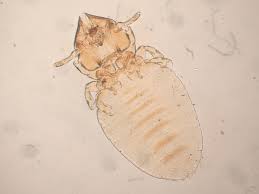 Attēlu rezultāti vaicājumam “Licea pygmaea sessile”