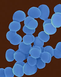 Attēlu rezultāti vaicājumam “Ceriporia viridans”