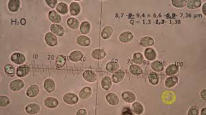 Attēlu rezultāti vaicājumam “Radulomyces confluens”