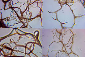 Attēlu rezultāti vaicājumam “Stemonitopsis gracilis”